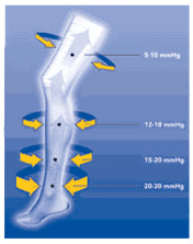 Gradient compression stockings, South Shore MA, venous disease, compression therapy, Cape Cod, Boston, manage edema, lymphatic disease